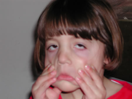 Click to display next picture