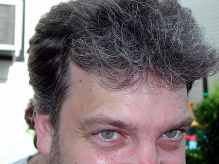 Click to display next picture